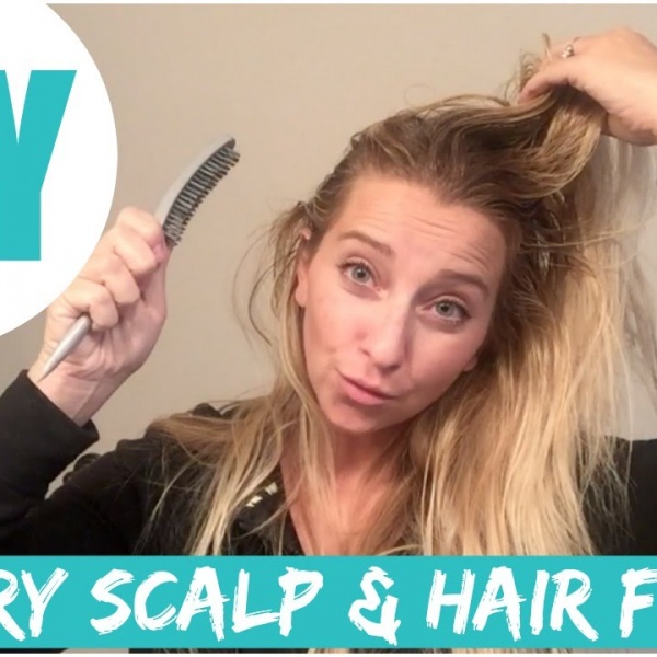 Easy & Affordable DIY Dry Scalp & Hair Fix