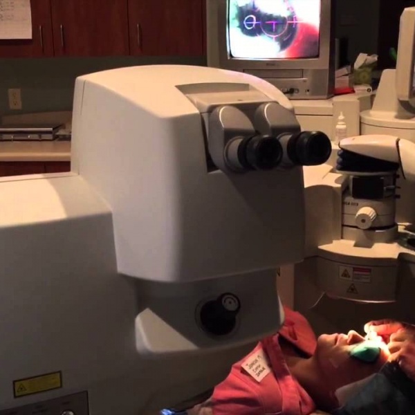 Getting Ready for LASIK:  What to Expect and Actual Video of the Process